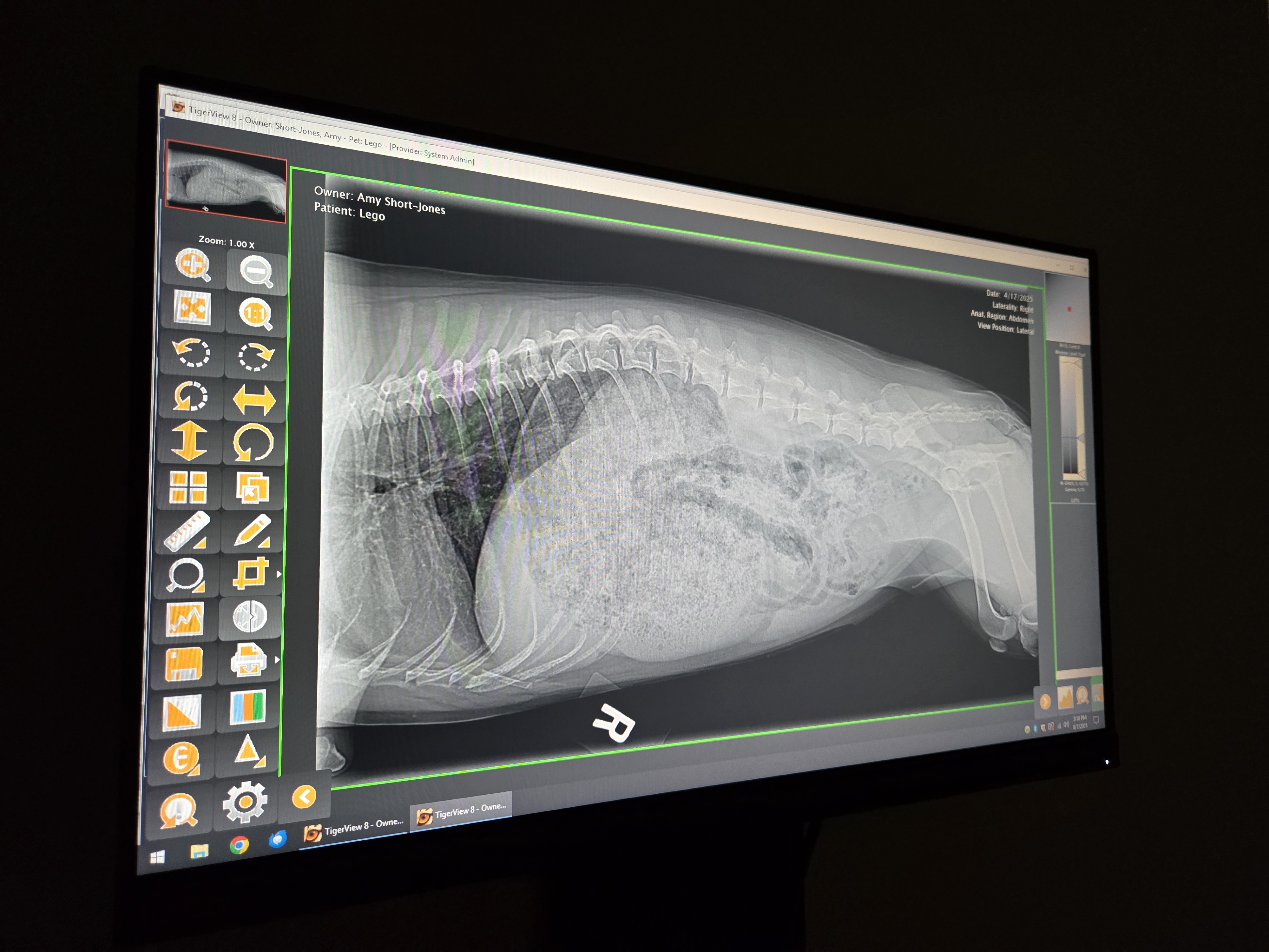 Digital X-ray